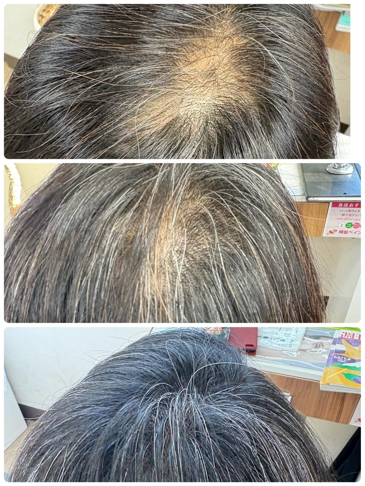 ヒト幹細胞 HSC強髪